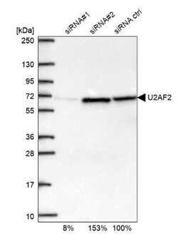 U2AF2 Antibody, Novus Biologicals 0.1mL; Unlabeled:Antibodies, Polyclonal